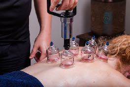 Myofascial Cupping